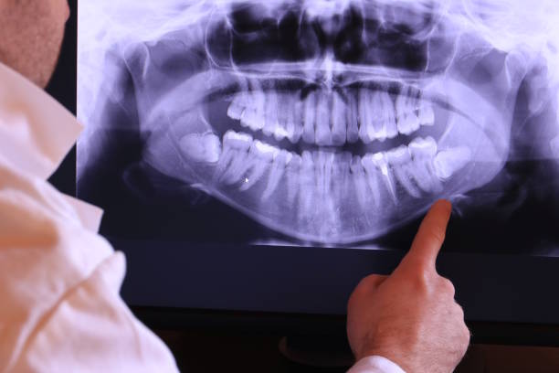 Best Dental Abscess Treatment in Manchester, WA